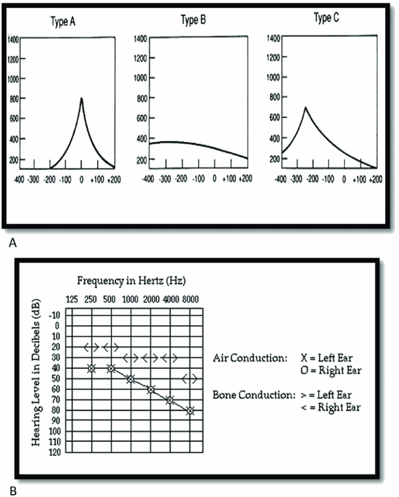 Zakres słuchu w decybelach
